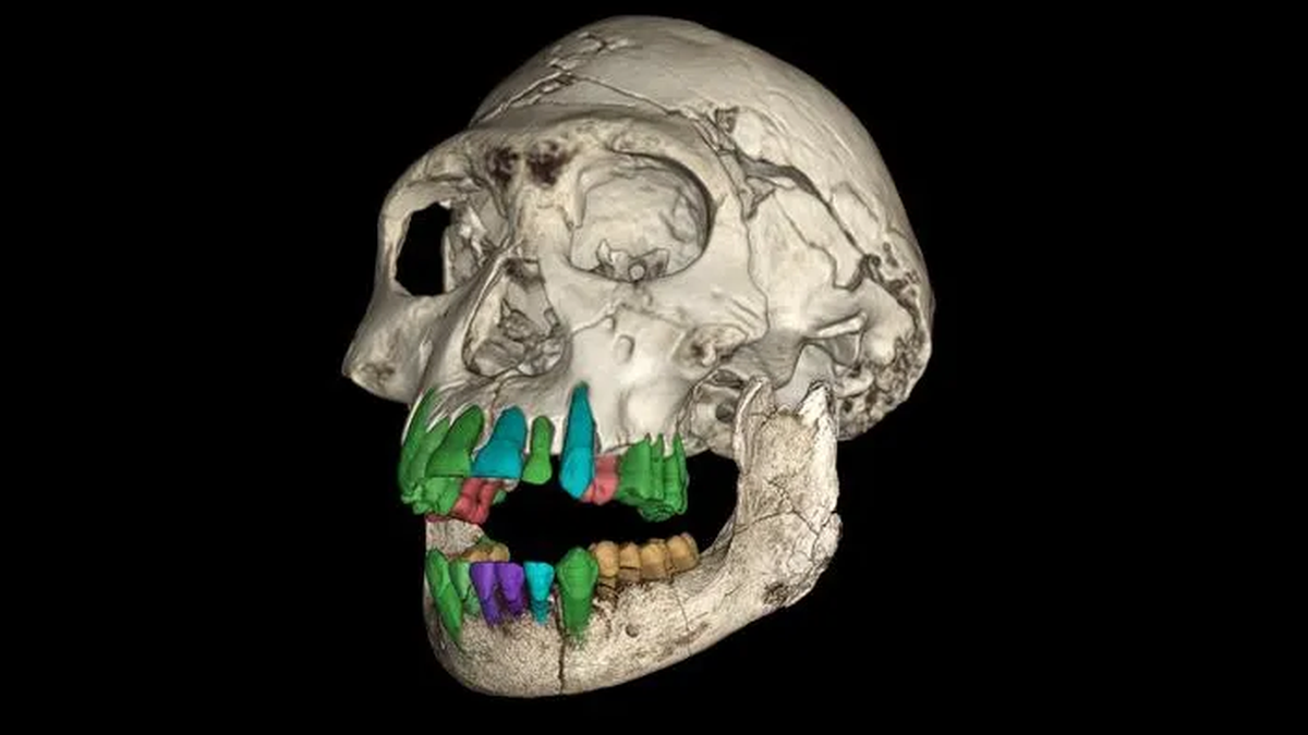 Reconstrucción en 3D del cráneo fósil de un niño de una especie temprana de Homo. Reconstrucción en 3D del cráneo fósil de un niño de una especie temprana de Homo.