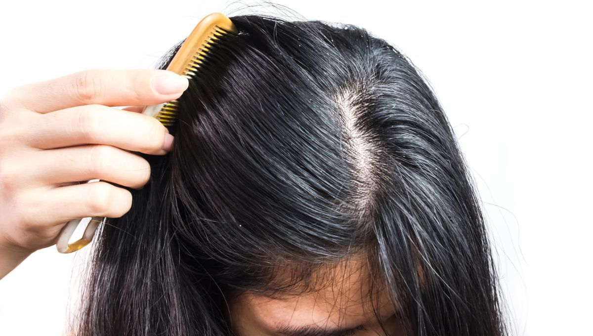 2 soluciones naturales para reducir la grasitud en el cabello