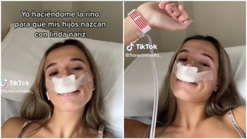 Se operó la nariz para que 