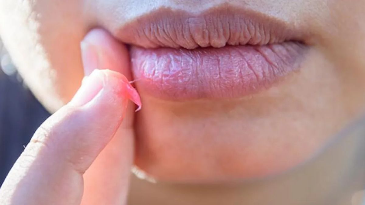 Los labios paspados se pueden curar de forma fácil y rápida con algunos remedios caseros. Los labios paspados se pueden curar de forma fácil y rápida con algunos remedios caseros.