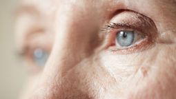 Los ojos suelen hincharse cuando los valores de azúcar en sangre son elevados.