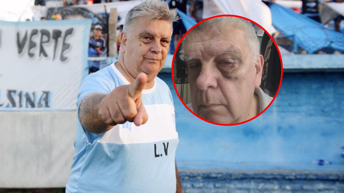 El DT fue hospitalizado tras el golpe.