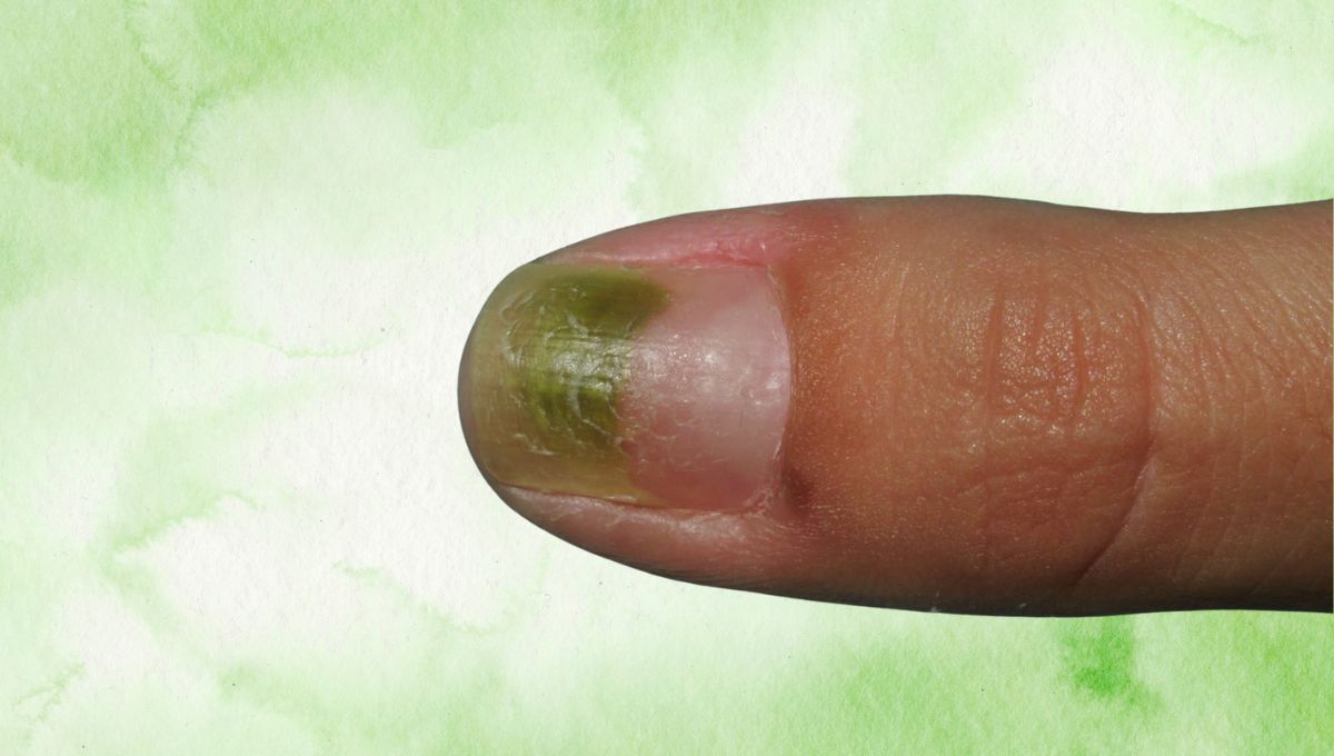 Uñas verdes. Uñas verdes.