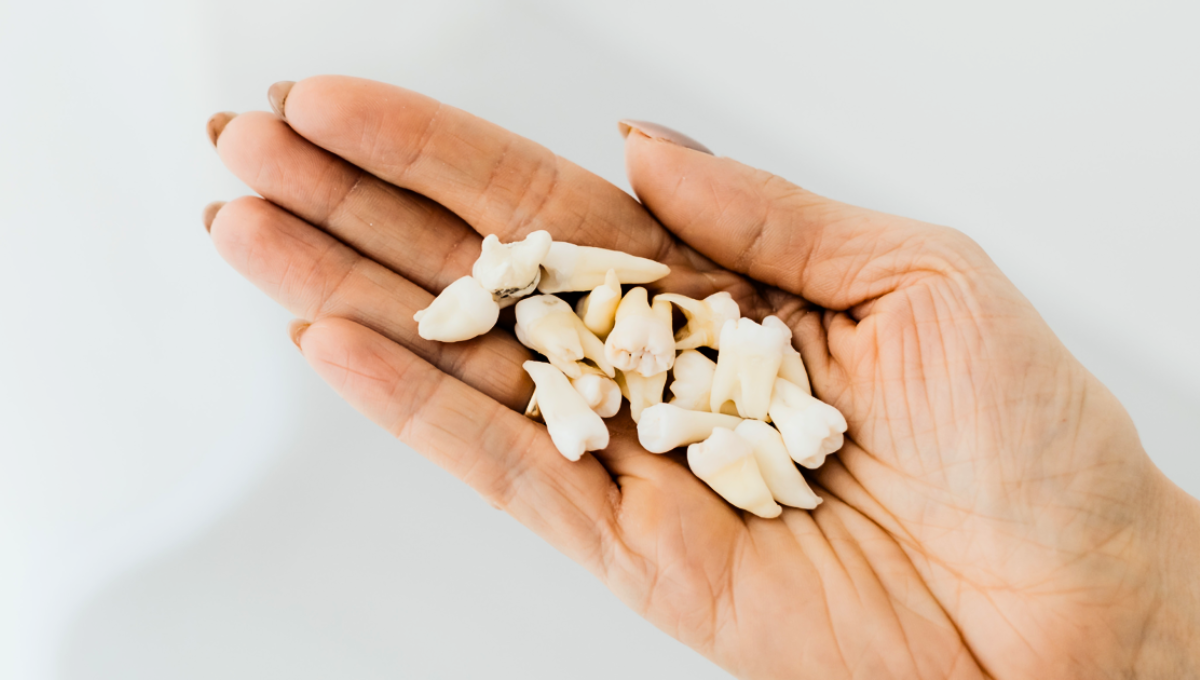 Soñar que se caen tus dientes es más común de lo que parece