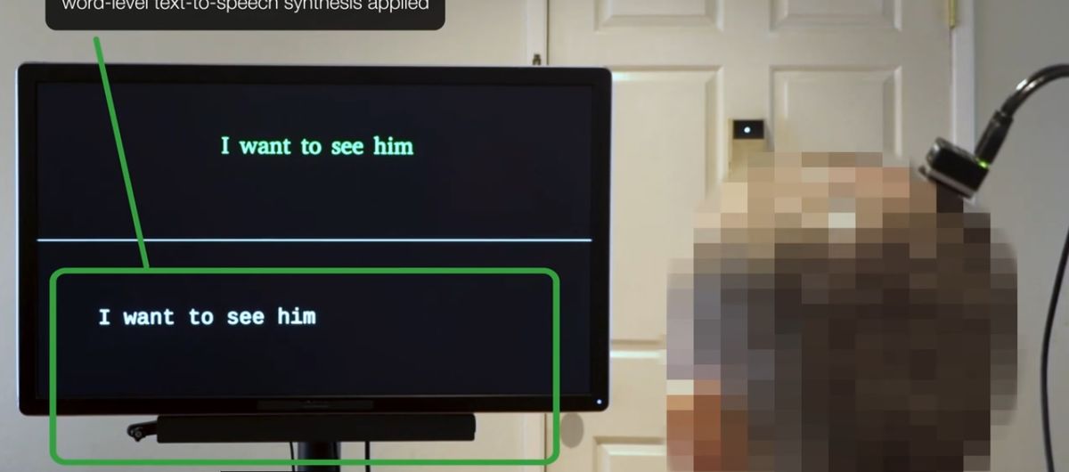 El revolucionario implante creado por la ciencia, en funcionamiento. El revolucionario implante creado por la ciencia, en funcionamiento.