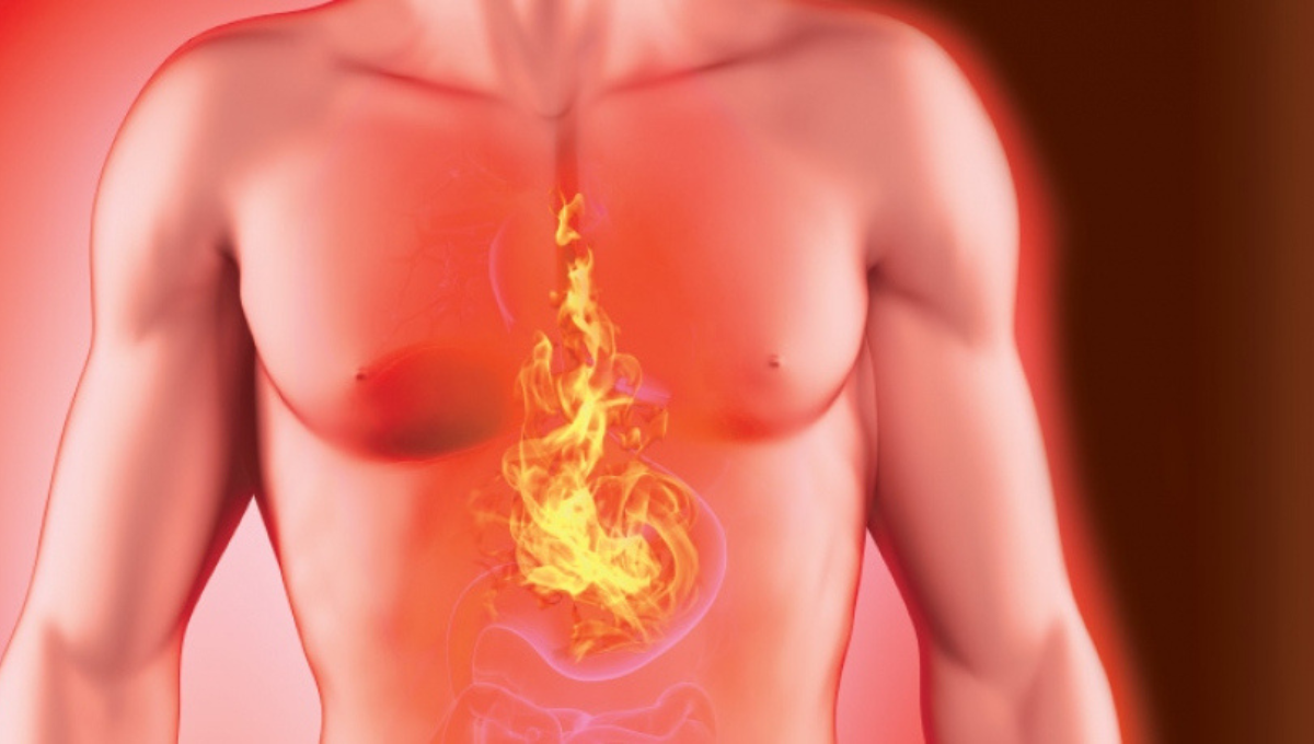 Qué alimentos provocan acidez