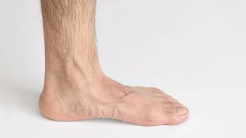 Vello en los pies: por qué la falta de pelos podría ser una señal de alerta médica Vello en los pies: por qué la falta de pelos podría ser una señal de alerta médica