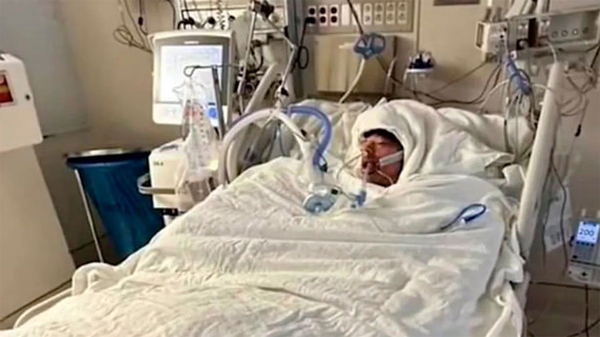 Quiso hacer un desafío de TikTok y terminó con el 75 por ciento del cuerpo quemado. (Imagen GoFund).