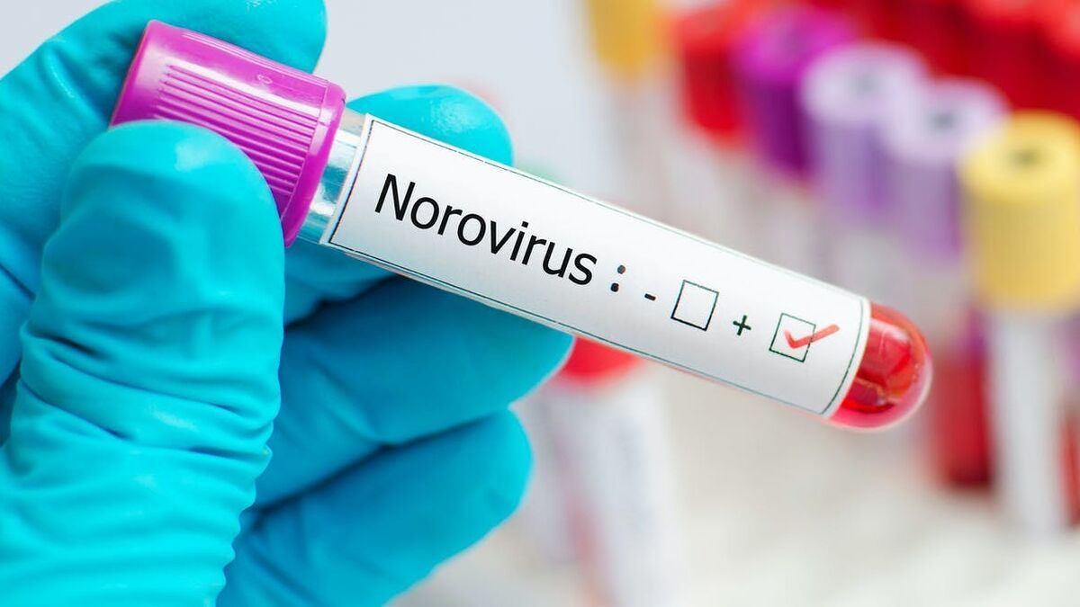 Qué Es El Norovirus Y Cuáles Son Los Síntomas Del Contagioso Virus Del Vómito 1963