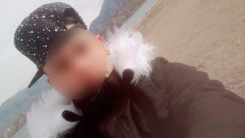 Asaltaron y balearon en la cara a una funcionaria sanjuanina del Senasa en Guaymallén
