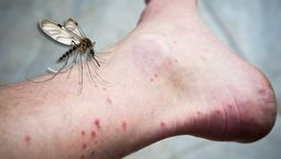 Por qué los mosquitos pican más en algunas partes del cuerpo que en otras.&nbsp;