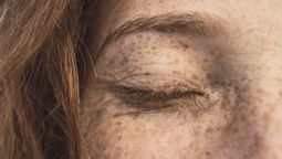 Qué significa que nazca una persona con pecas dentro del árbol familiar