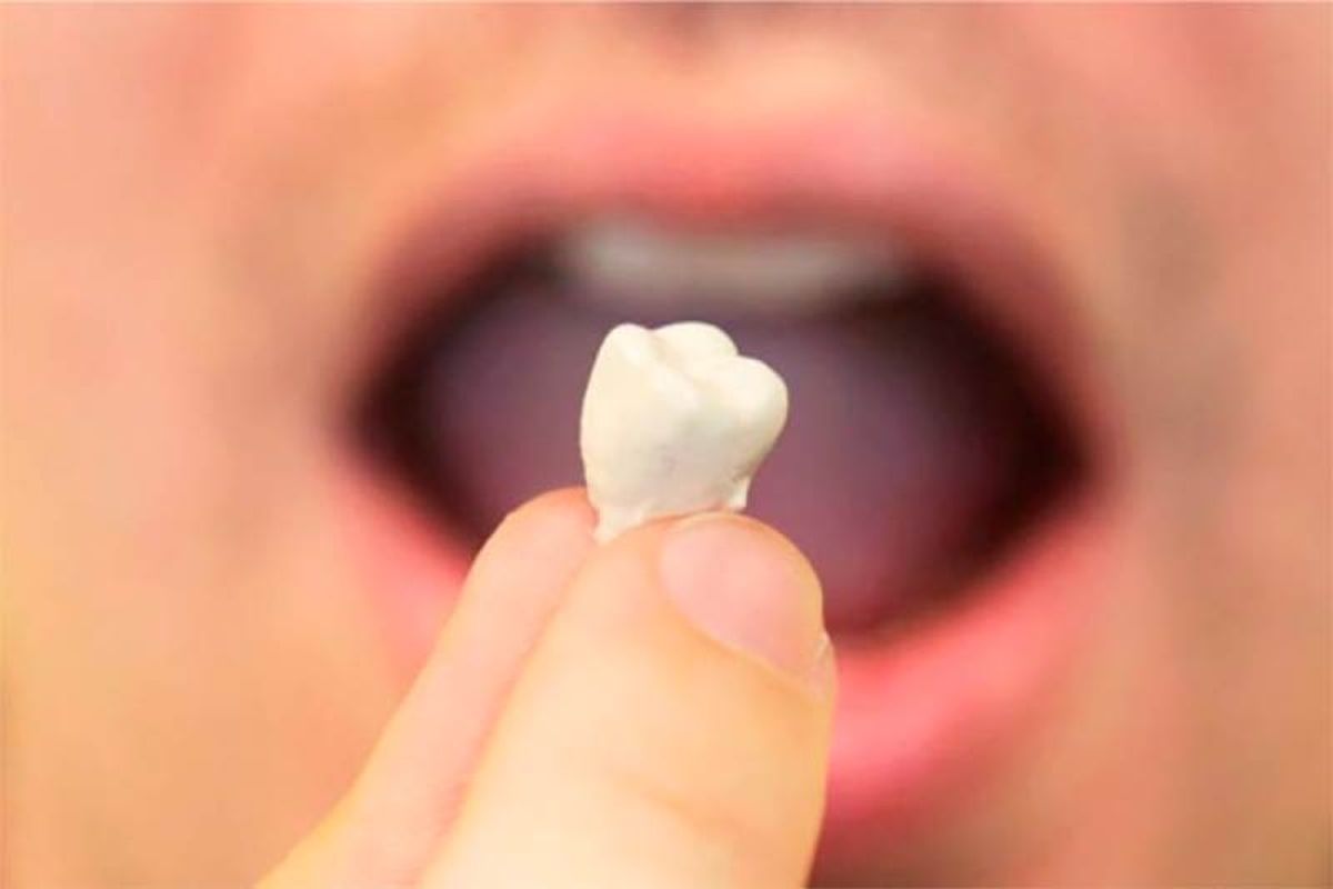 El estrés suele ser la causa principal de este problema. El estrés suele ser la causa principal de este problema. 