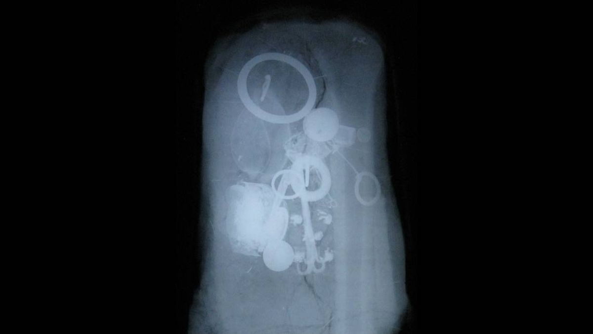 Las fotografías publicadas también muestran los artefactos después de haber sido sometidos a rayos X y posteriormente restaurados. Las fotografías publicadas también muestran los artefactos después de haber sido sometidos a rayos X y posteriormente restaurados.