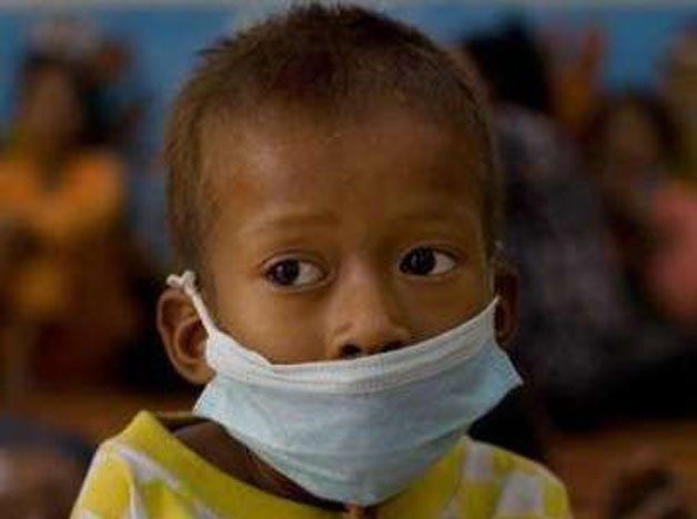 La tuberculosis infantil, un problema subestimado por la OMS, según un estudio