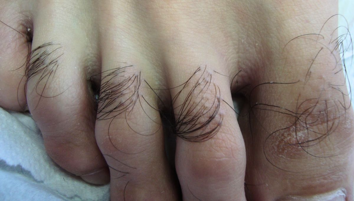 Los pelos de los pies son sinónimo de buena salud.&nbsp;