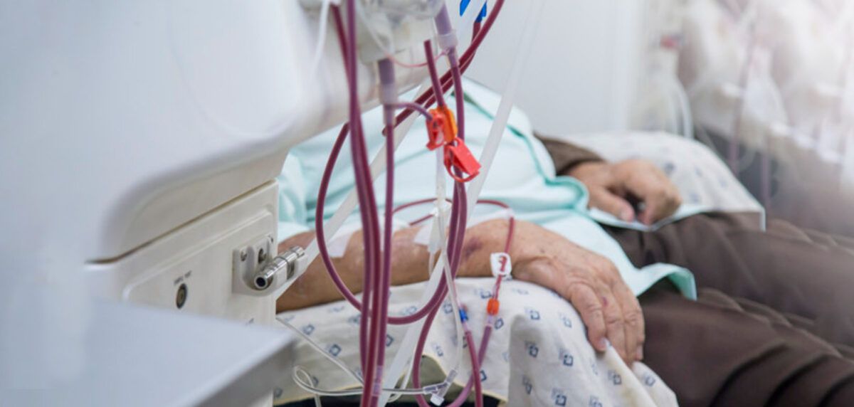 Para muchos pacientes, el tratamiento de hemodiálisis es una cuestión de vida o muerte. Para muchos pacientes, el tratamiento de hemodiálisis es una cuestión de vida o muerte.