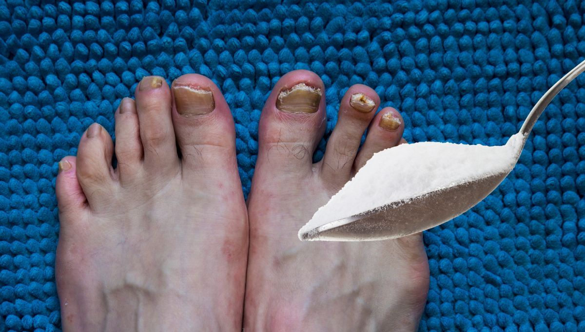 Por qué hay que ponerse bicarbonato en las uñas y para qué sirve