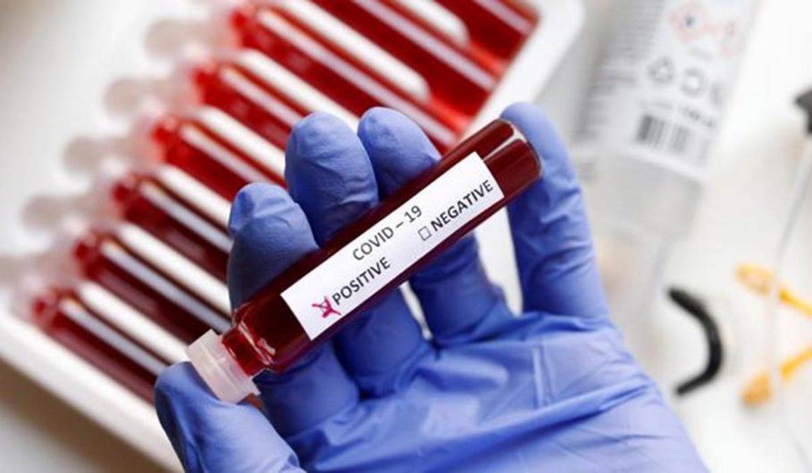 El grupo sanguíneo de una persona también podría determinar la susceptibilidad a contraer coronavirus y la gravedad de la enfermedad