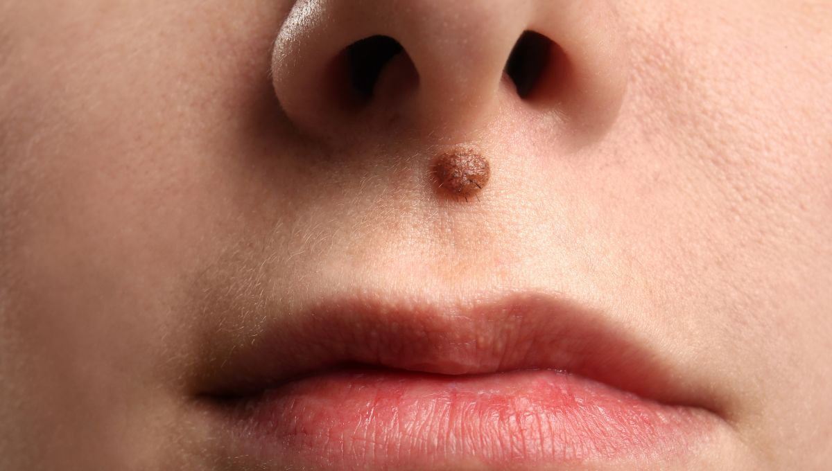 Lunar nariz. Lunar nariz. 