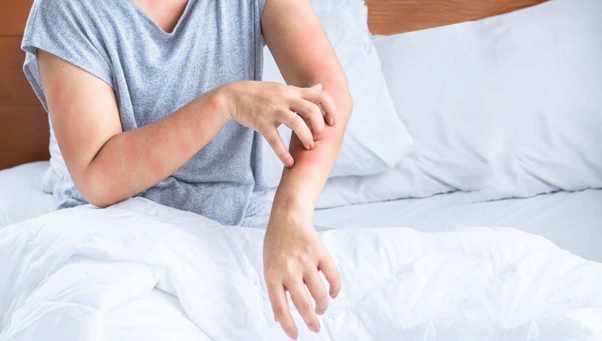 Los ácaros pueden generar alergia, picazón, estornudos e irritación. Los ácaros pueden generar alergia, picazón, estornudos e irritación. 