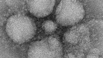 Alertan por un nuevo virus a nivel mundial