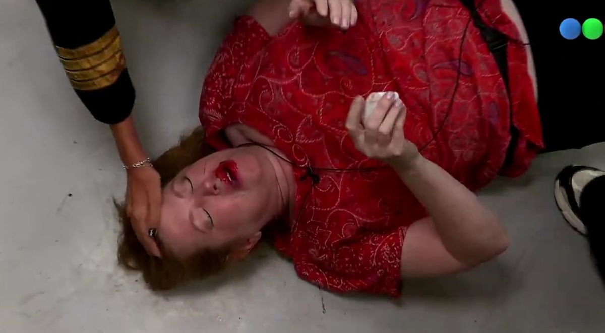 La imagen completa de Andrea del Boca tras su accidente en Gran Hermano.