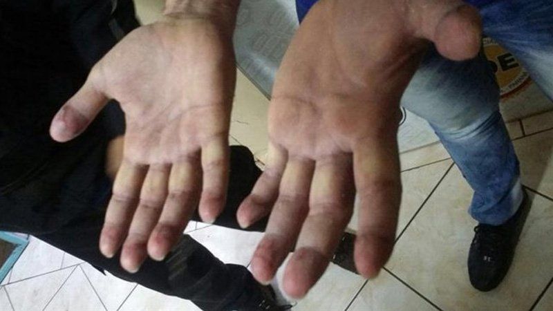 Oscar Delgado: No hay delito por quitarte las huellas digitales.