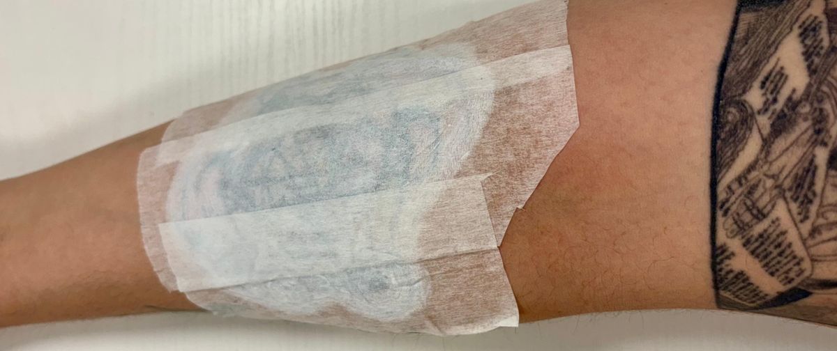 Lo ideal es cubrir las zonas tatuadas y pasar el láser solo en las zonas alrededor. Lo ideal es cubrir las zonas tatuadas y pasar el láser solo en las zonas alrededor.