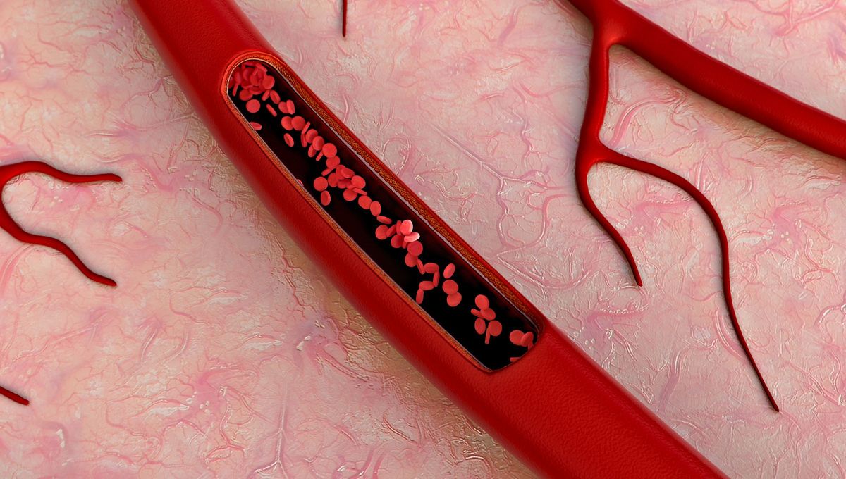 La sangre es uno de los fluidos vitales que permiten a los cuerpos sobrevivir y la evolución la ha convertido en un líquido básico para la vida. La sangre es uno de los fluidos vitales que permiten a los cuerpos sobrevivir y la evolución la ha convertido en un líquido básico para la vida.