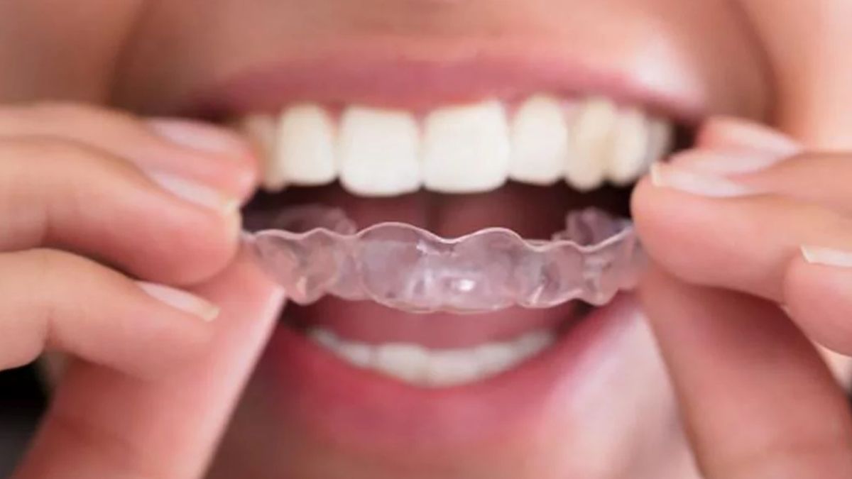 Trucos caseros. Complementar el uso de protector dental con estos consejos es la mejor forma de reducir el bruxismo. Trucos caseros. Complementar el uso de protector dental con estos consejos es la mejor forma de reducir el bruxismo.