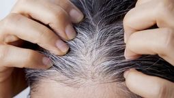 Existen trucos caseros increíbles para eliminar las canas de manera natural.