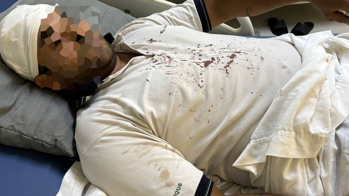 El chofer de micro del grupo 900 asaltado y golpeado por unos 10 jóvenes en Guaymallén.