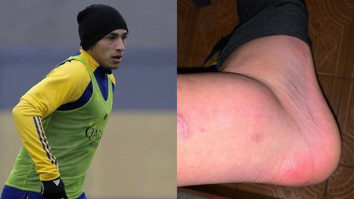 El juvenil de Boca pidió jugar con el tobillo destrozado