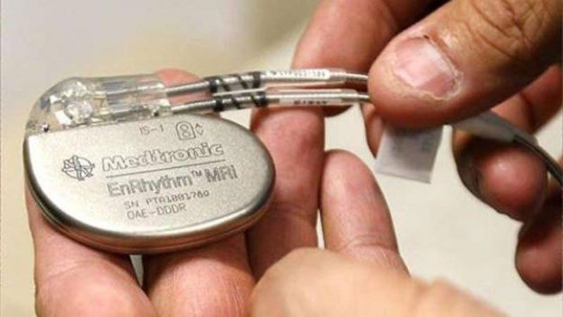 Aprobaron en Estados Unidos el primer marcapasos inalámbrico