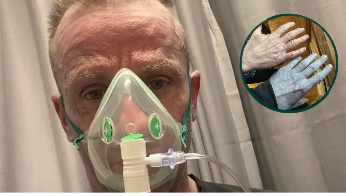 Despertó completamente azul y corrió al hospital: la insólita razón estaba en su cama
