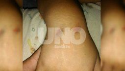 Brutal: el relato de la mamá del nene de 3 años picaneado por delincuentes