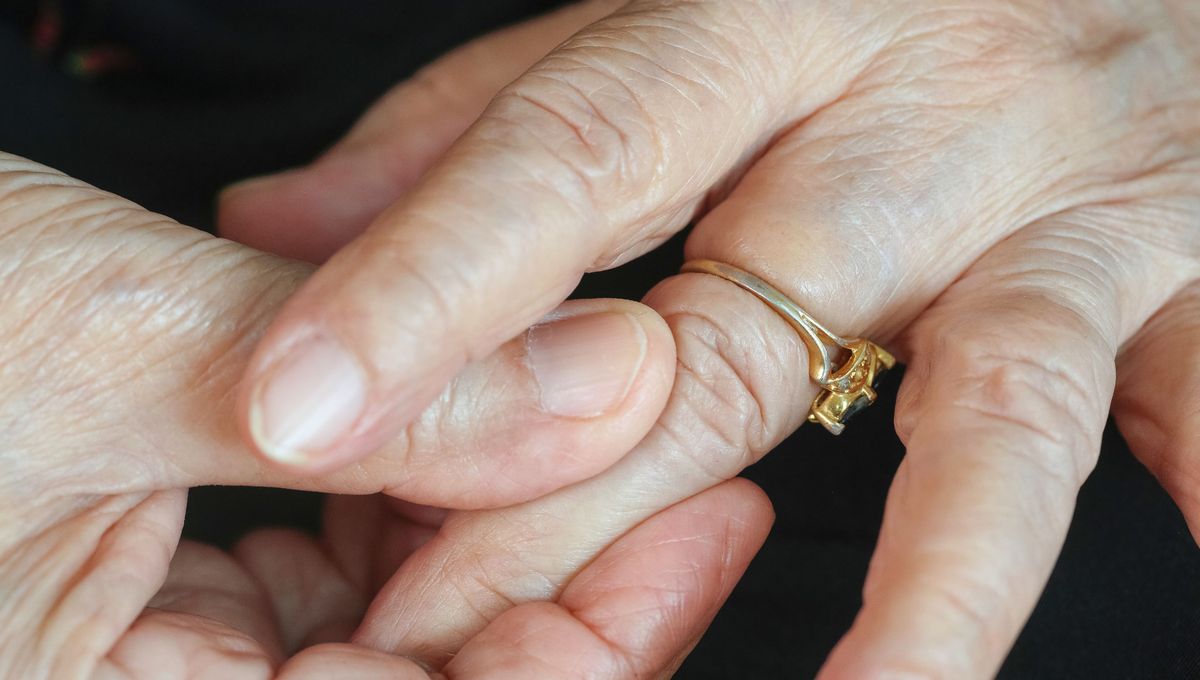 Con un truco y 2 ingredientes: cómo sacarte un anillo atorado en el dedo