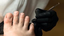 Con esta rutina, puedes eliminar y hasta prevenir el color amarillo en tus uñas