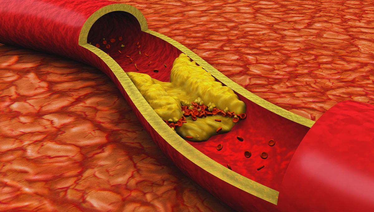 Cuida tu salud: cómo limpiar tus arterias para tener una vida plena y vivir 100 años