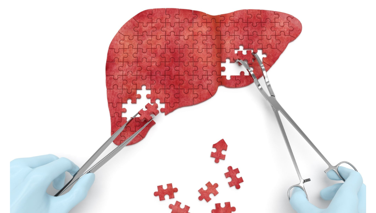 Día mundial contra la hepatitis: ¿por qué se conmemora el 28 de julio?