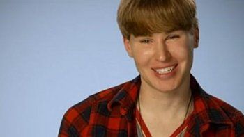 Murió el hombre que gastó 100.000 dólares en cirugías para parecerse a Justin Bieber