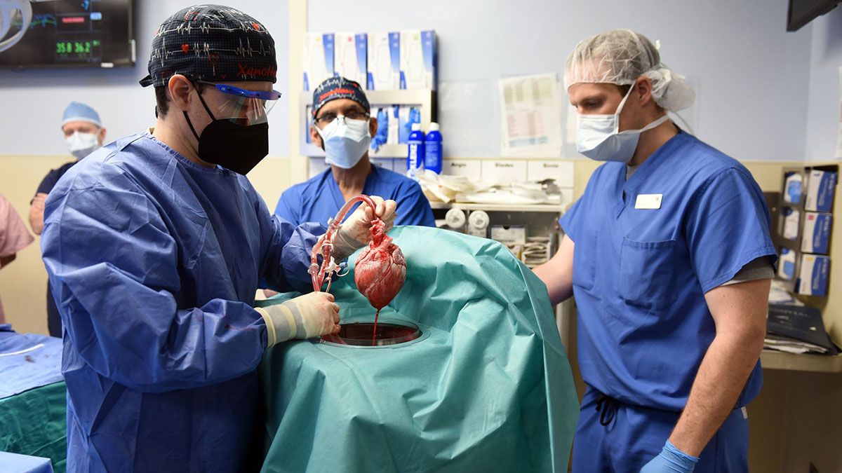 El equipo médico que trasplantó un corazón de cerdo a un hombre de 57 años