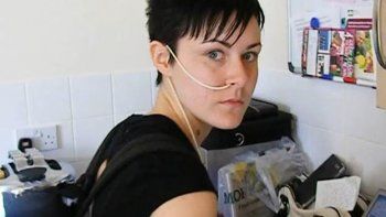 Se curó de su anorexia con bótox