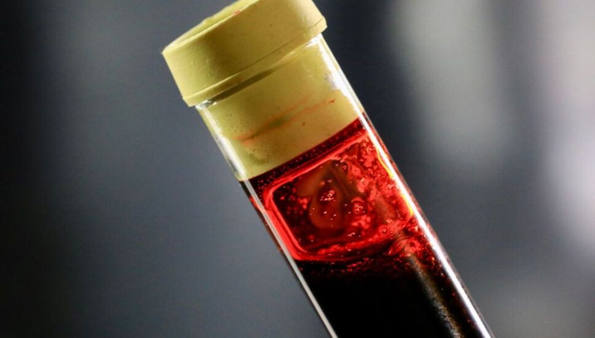 El descubrimiento de un nuevo grupo sanguíneo que se dio después de 50 años El descubrimiento de un nuevo grupo sanguíneo que se dio después de 50 años