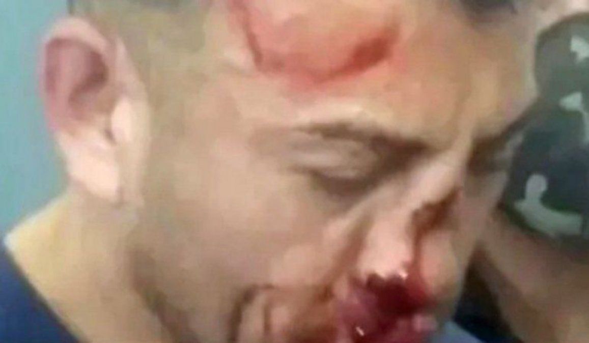 El fisicoculturista Samuel Llanos, femicida de Analía Maldonado, fue golpeado por presos en una comisario, y quedó con el rostro ensangrentado y el tabique nasal roto