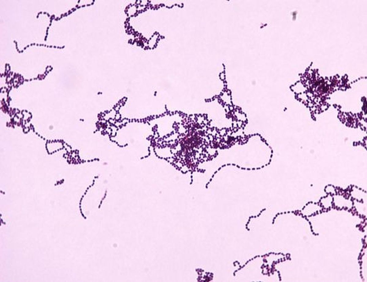 Una imagen de Streptococcus pyogenes.