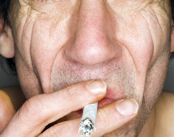 Fotos de gemelos revelan cómo el cigarrillo provoca el envejecimiento