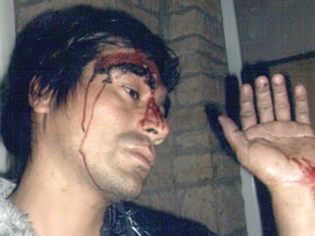 Denunciaron a dos policías por la golpiza a un hombre en una discusión de tránsito