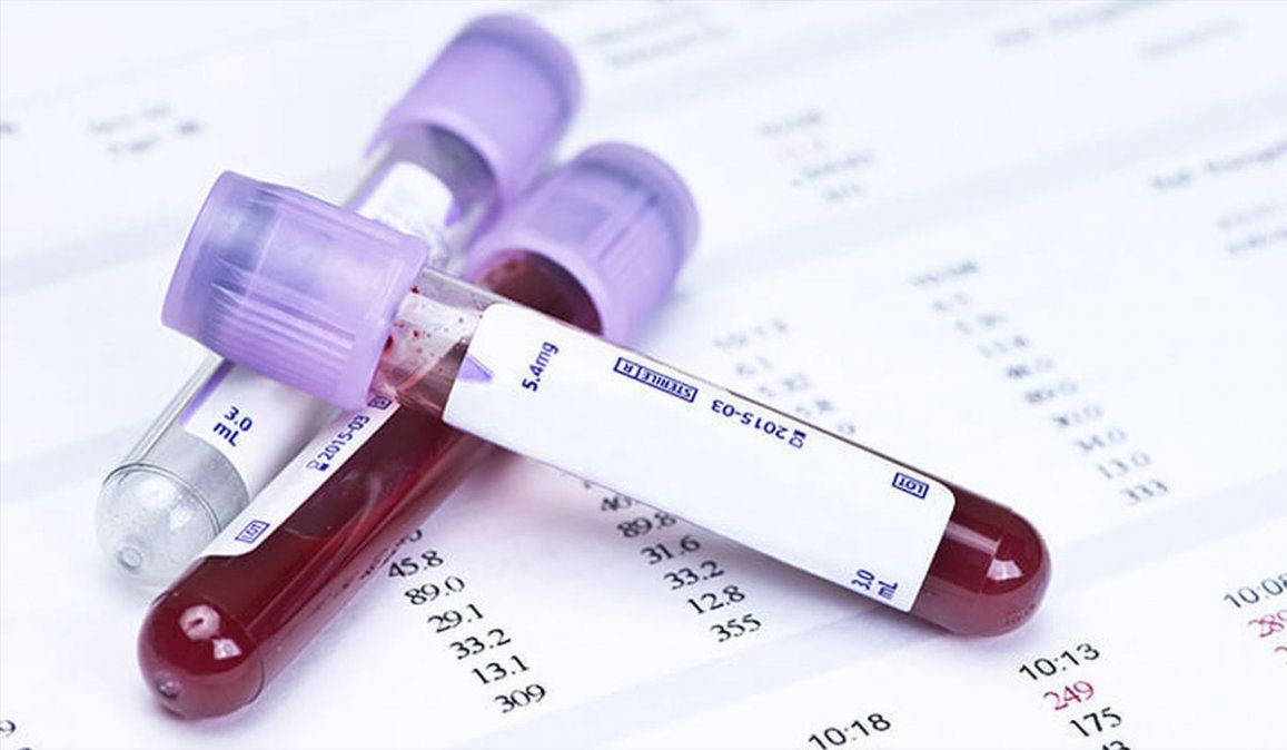 Un estudio advierte que el coronavirus se siente "particularmente atraído" por el grupo sanguíneo A